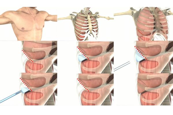 Medical Animation