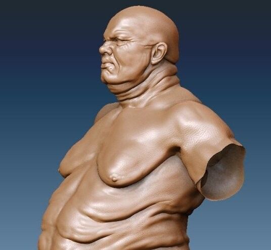 Obesity art test