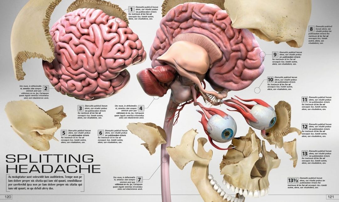 splitting head