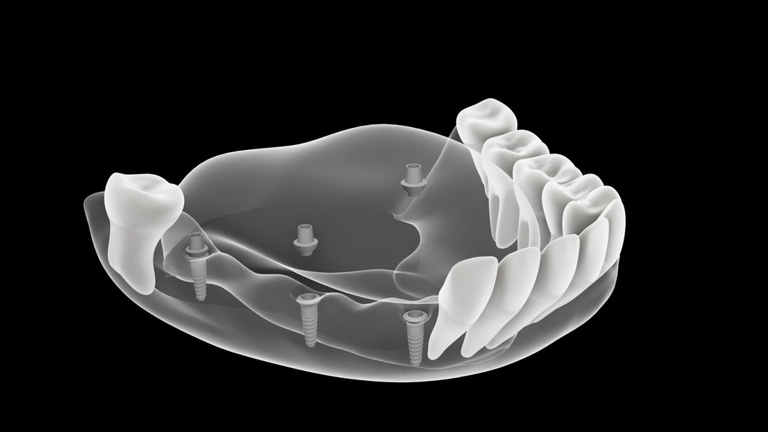 Teeth procedure