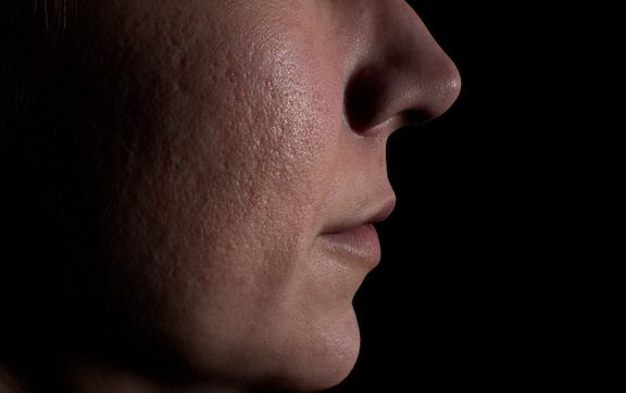 Isidora Custom Character