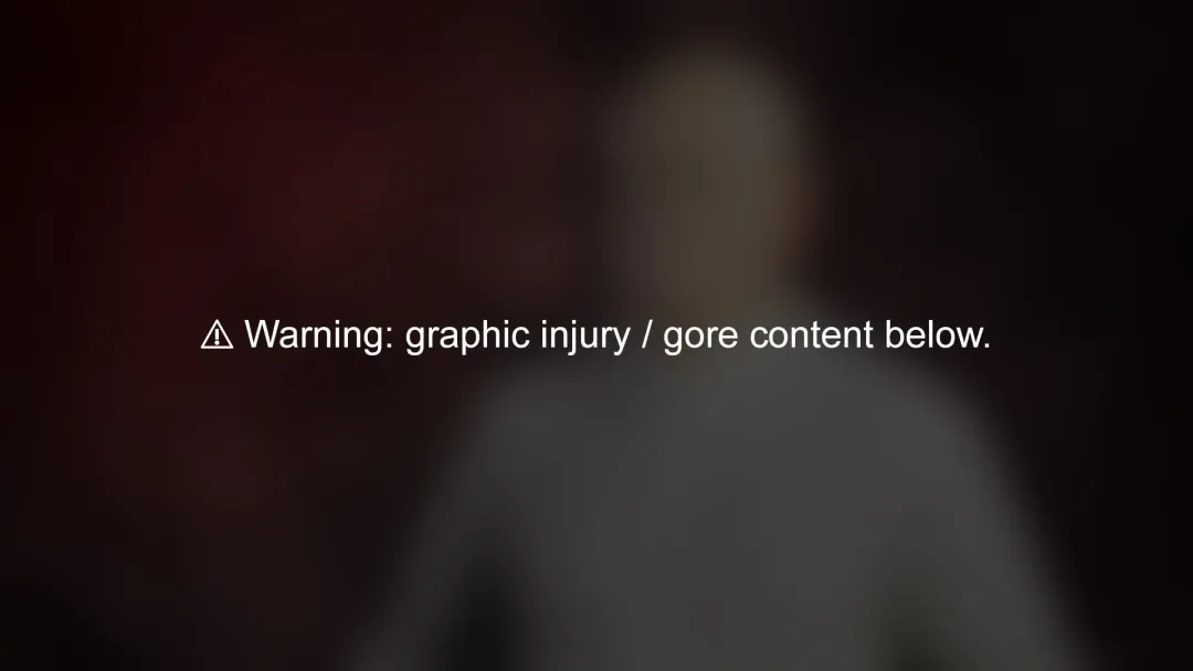 Doctor's injuries