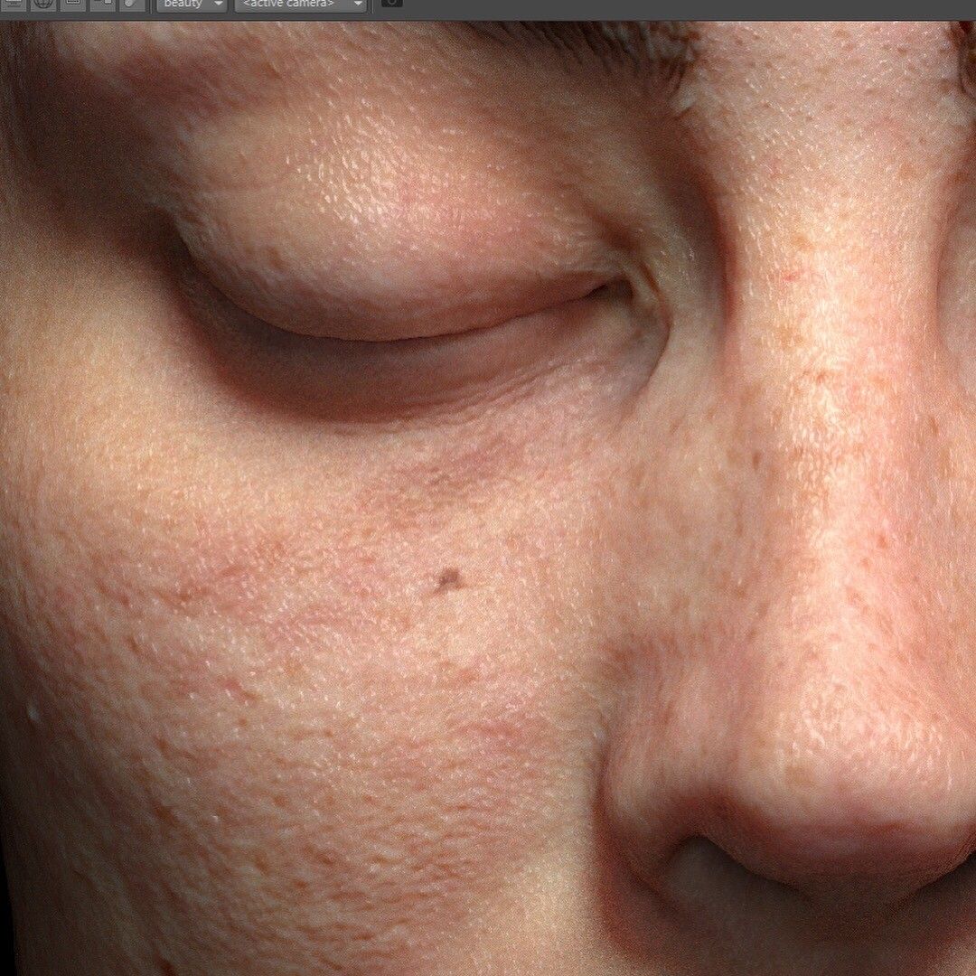 skin test