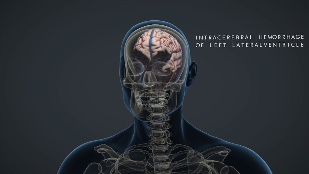 Medical Animation rendered in Arnold